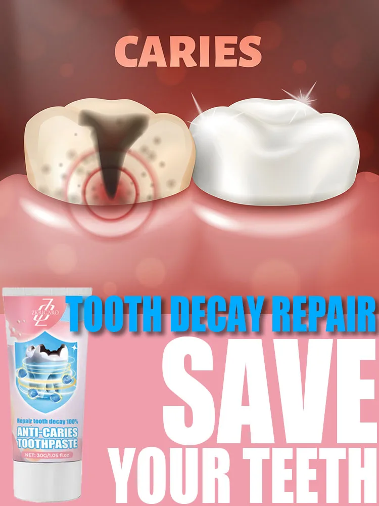 Anti-Cavity Toothpaste Tooth Remineralization Recovery Enamel Repair Strengthening Restoration Decay Protection Dental Teeth