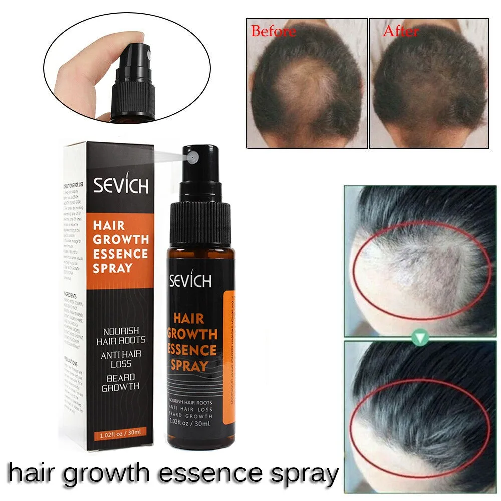 air Growth Spray 20ml Hair Grows Restoration Prevent Baldness