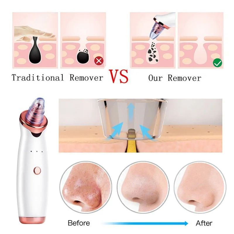 Updated USB Blackhead Remover Face Pore Vacuum Skin Care Acne Pore Cleaner Pimple Removal Vacuum Suction Clean Skin Care Tools