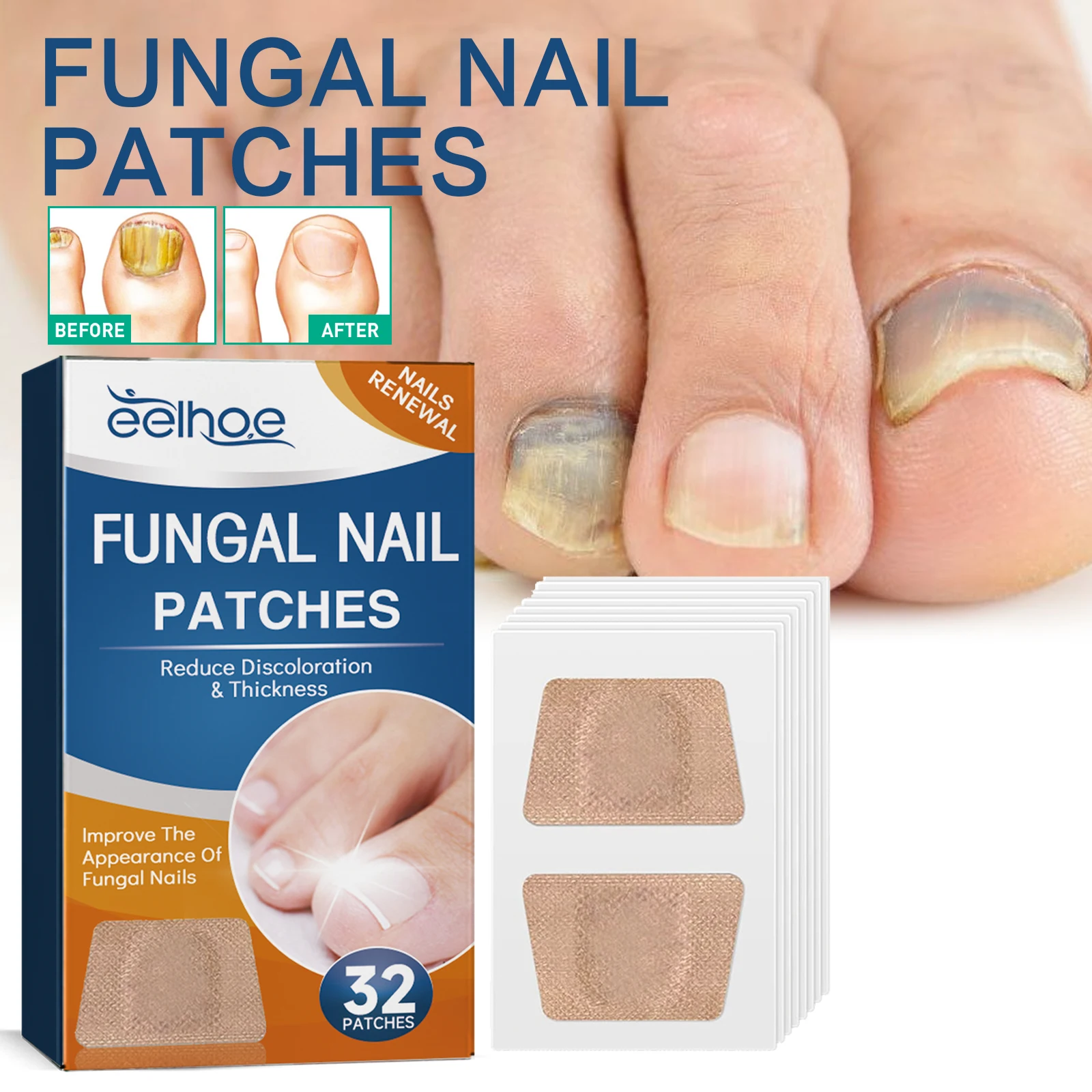 

Toenail Care Stickers for Yeast Infection Nail Fungus Foot Softening Ingrown Thickening Brightening Nail Groove Care Kit