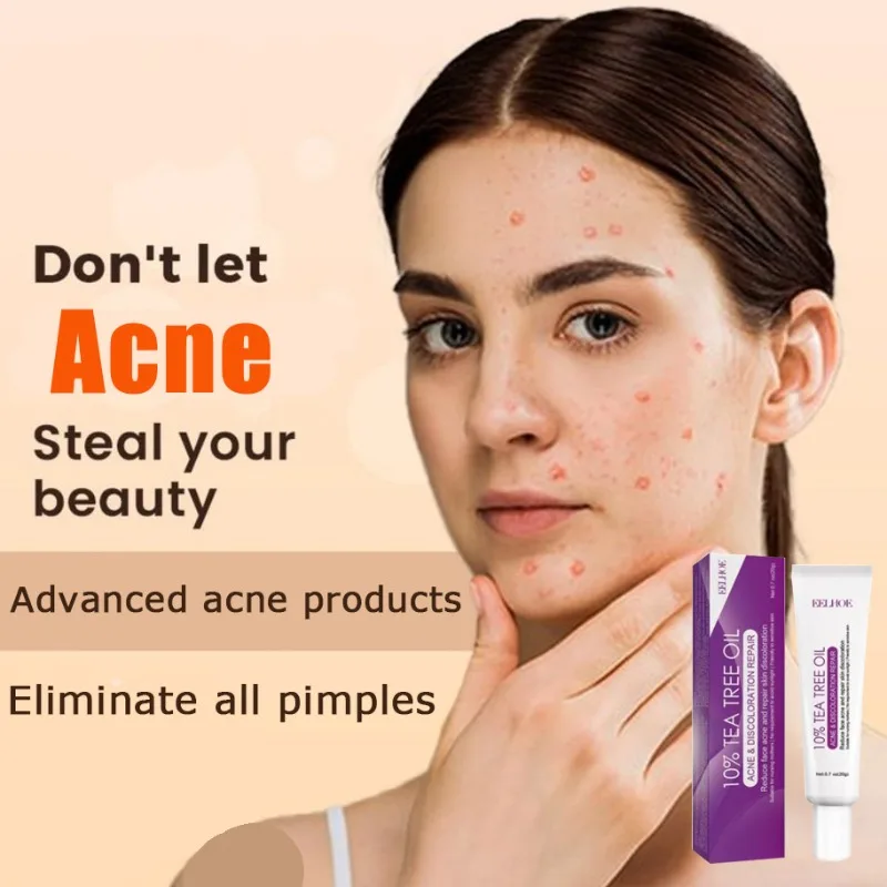 Крем для лица для удаления прыщей и удаления прыщей