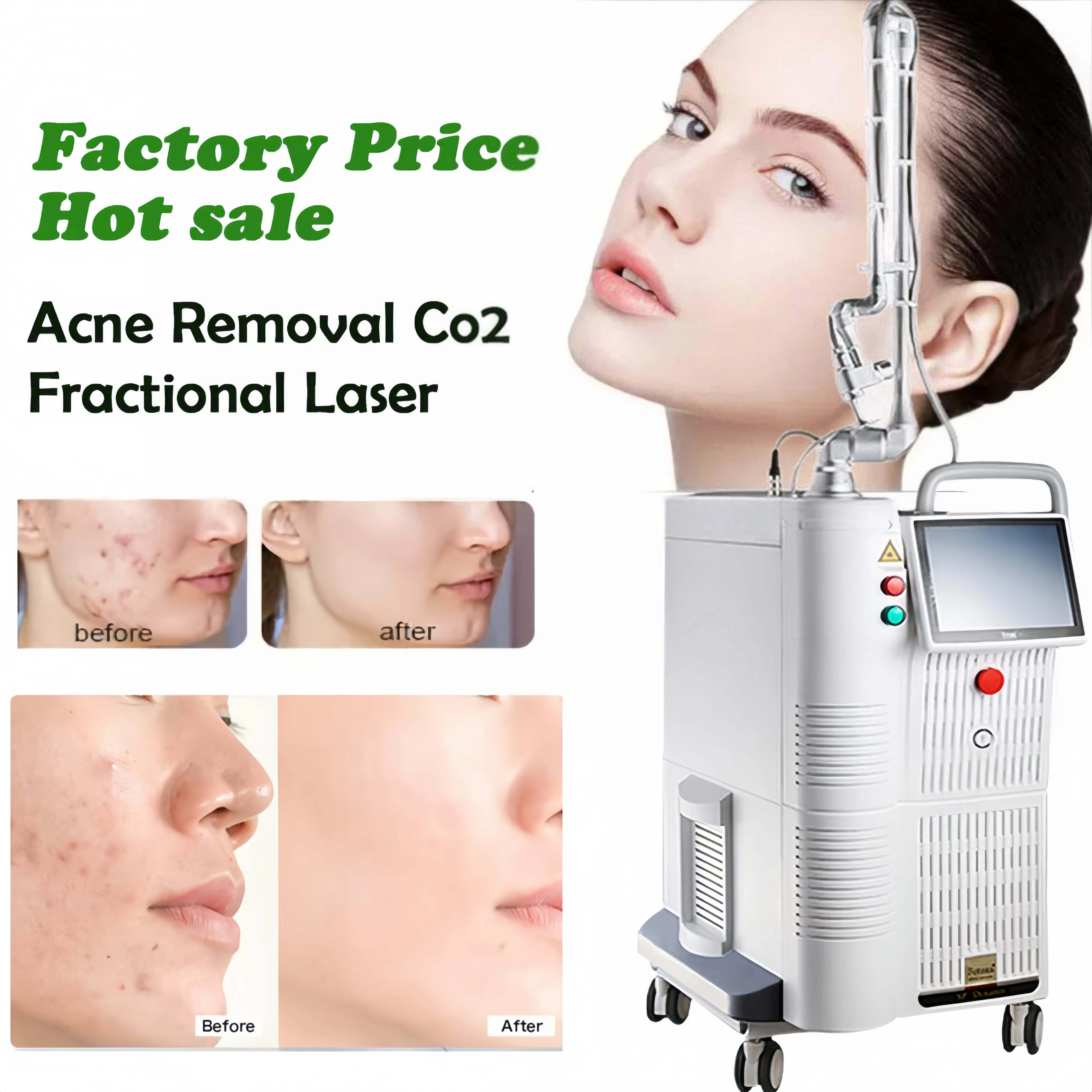 CO2 Fractional Lase Skin Rejuvenation Wrinkle Reduction Pigmentation Removal Scars Wrinkle Remover Beauty Machine