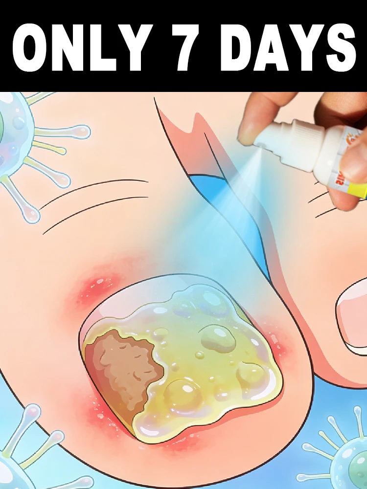 

Repair and protect in one step to completely ᵍᵉᵗ ʳⁱᵈ ᵒᶠ ᵒⁿʸᶜʰᵒᵐʸᶜᵒˢⁱˢ ᵃⁿᵈ ᵖʳᵉᵛᵉⁿᵗ ʳᵉᶜᵘʳʳᵉ