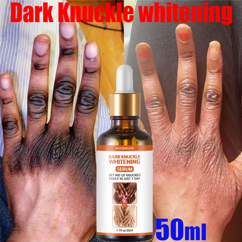 

Dark Knuckles Fast Whitening Serum Hand Knuckle Elbows Knee Melanin Corrector Intense Stain Remover Korean Beauty Skin Care 50ml