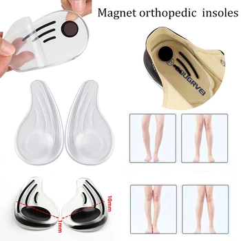 Tabanlık Ayak O/X Bacak Tipi Silikon Ortopedik Pedler Valgus Varus Düzeltme Plantar Fasiit Jel Astarı Mıknatıs Masaj Ayak Bakımı