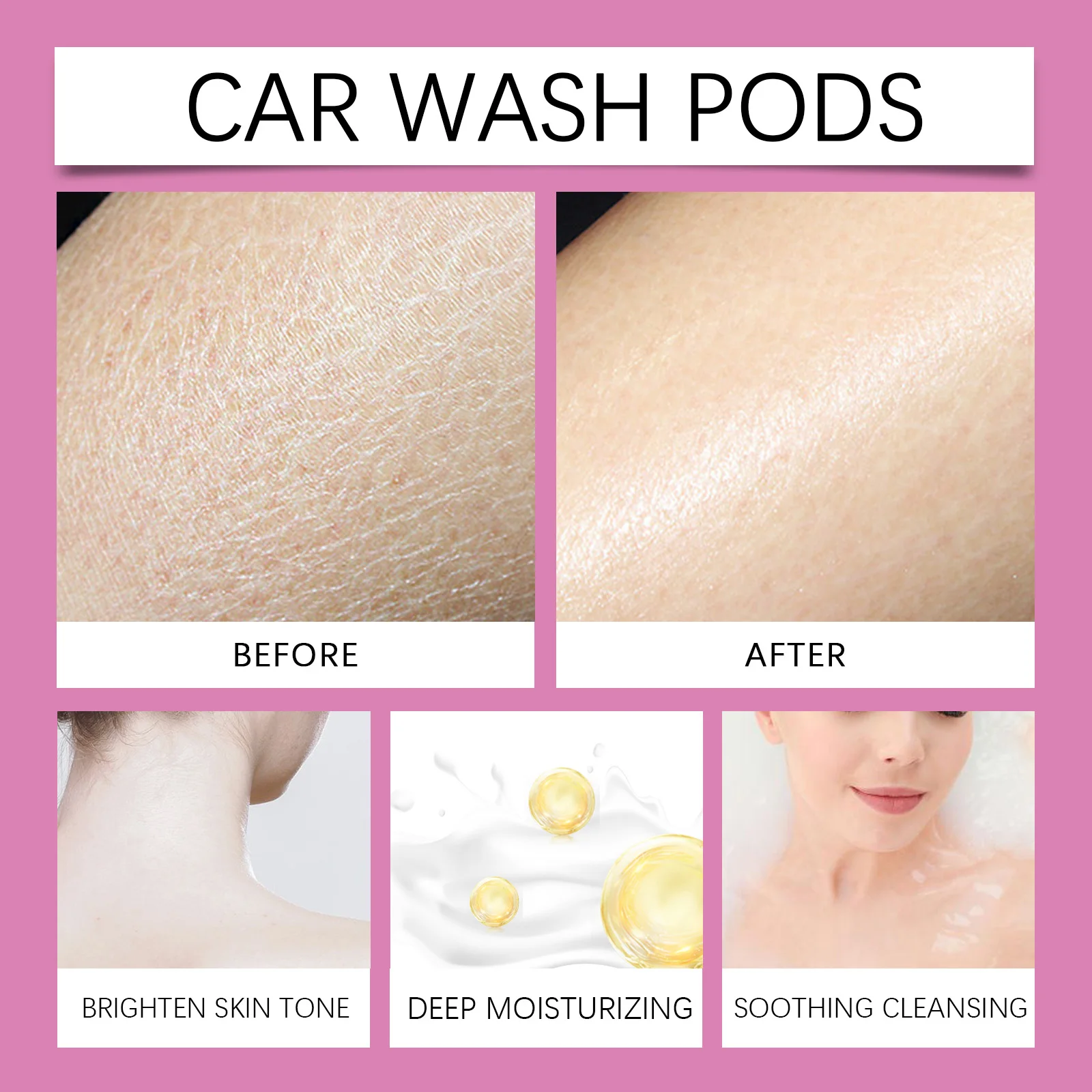 Body Brightening Yellow Peeling Oil,Visible Chemical Peeling&Renewal,Barrier Support&Collagen Restoration&Firming,Deep Hydration&Dark Spot&Hyperpigmentation Corrector,Scars&Stretch Marks Corrector&110ml Large Capacity For Full Body,Vegan