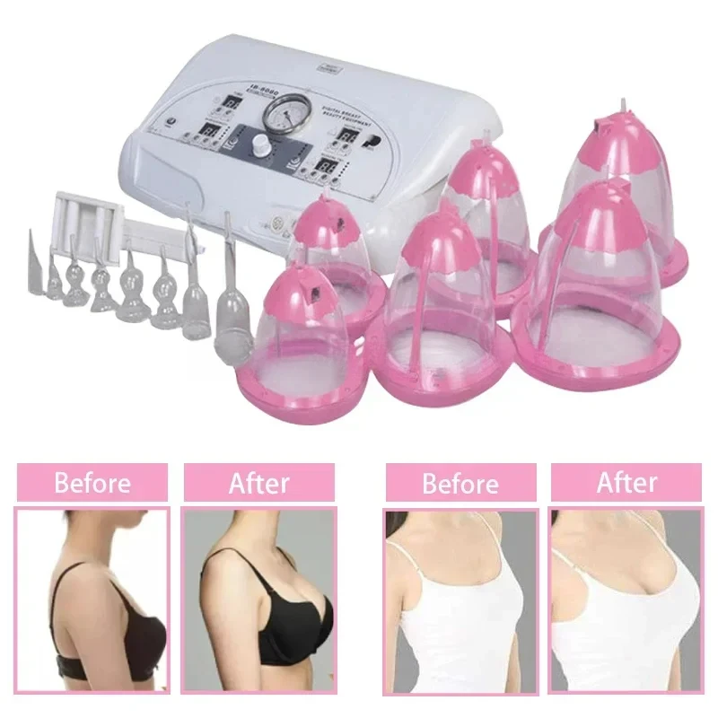 & Buttocks Enlargement Vibration Massage Body Cupping Breast Care Vacuum Therapy