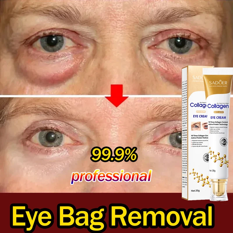 

Collagen Eye Bag Removal Cream Instant Anti Wrinkle Fade Fine Lines Brighten Dark Circles Anti Puffiness Eye Skin Care Cosmetics