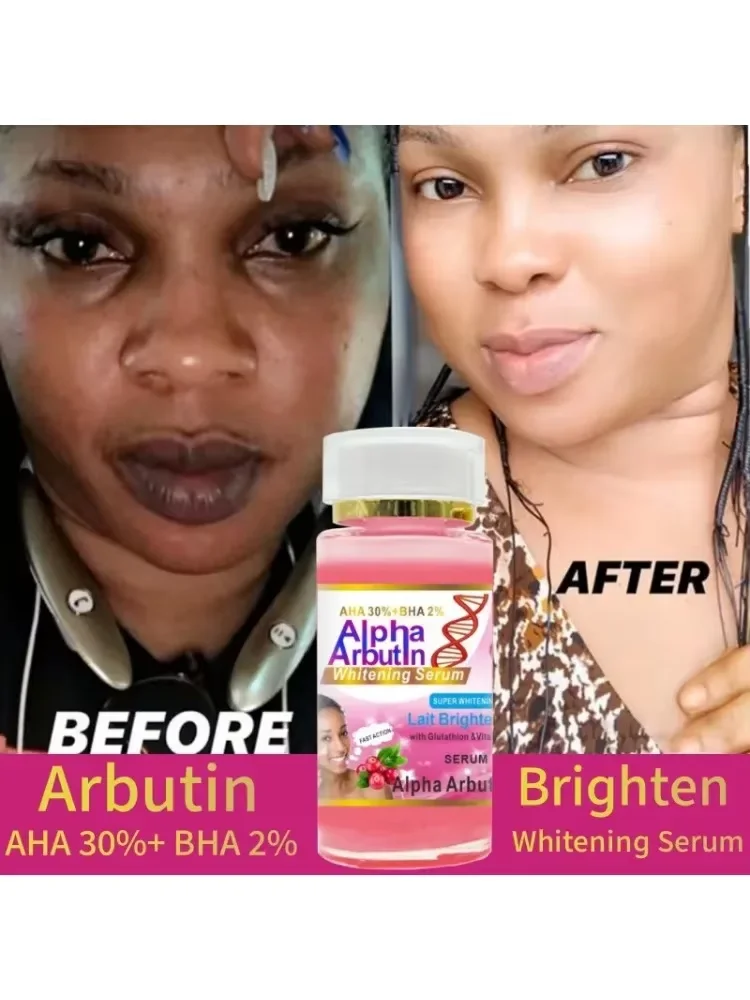 

Сыворотка с альфа-арбутином AHA 30%+ BHA 2% сохраняет лицо, гладкий, осветляющий, увлажняющий, улучшающий тусклость, крем для ухода за темной кожей