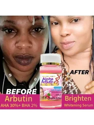 Alpha Arbutin Serum AHA 30%+ BHA 2% Keeps Face Smooth Brightening Moisturizing Improving Dullness Dark Skin Beauty Care Cream