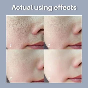 Retinol Niacinamide Refining Serum 4