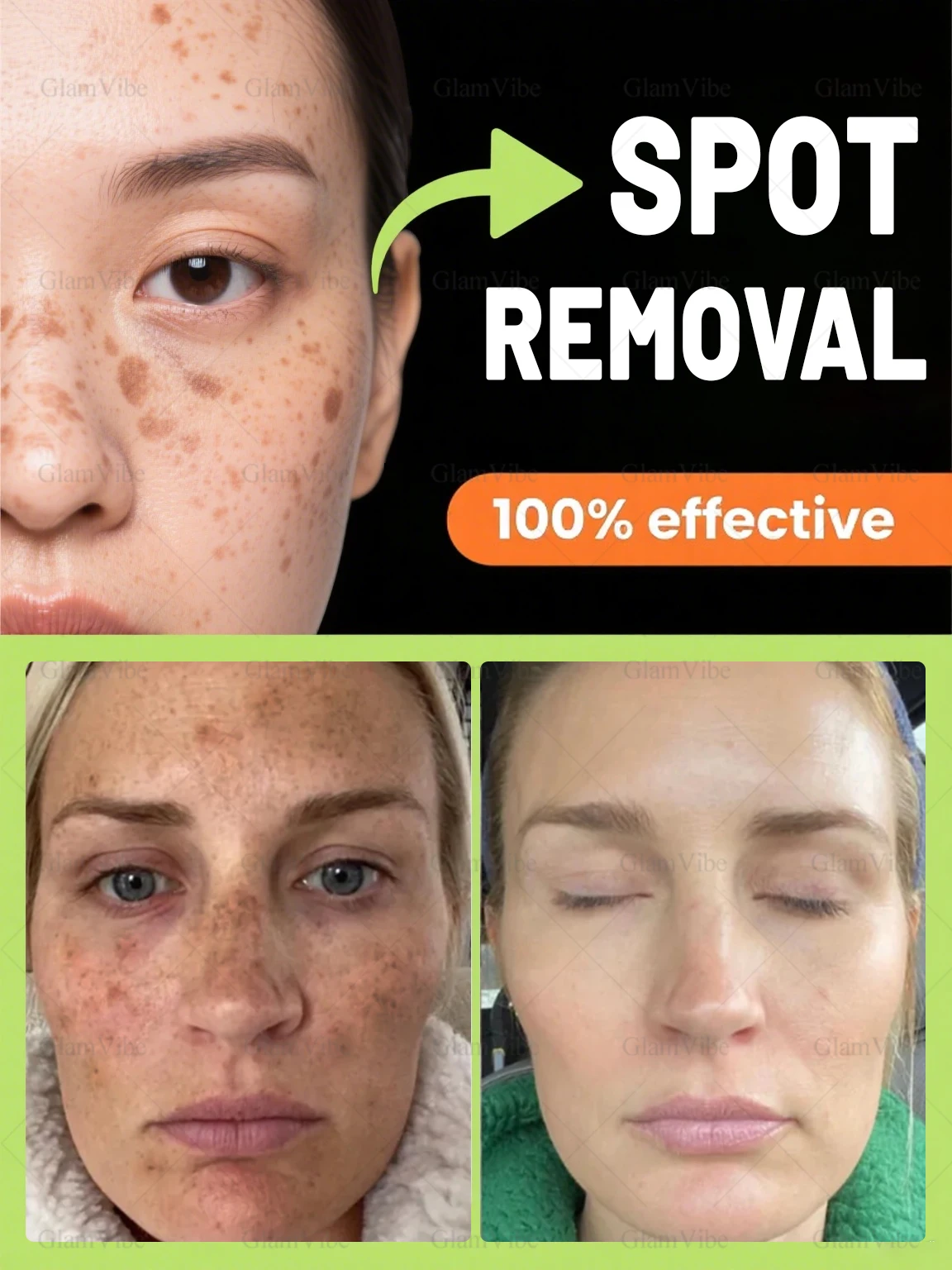 2025, strumenti per la cura della rimozione dei pigmenti, 100% efficaci