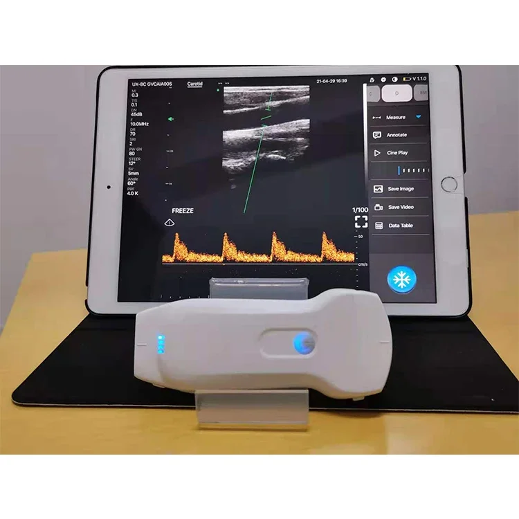 Medsinglong Color Doppler Handheld Wireless Ultrasound Scanner Portable Convex USB Wifi Double Probes Wireless Ultrasound Probe