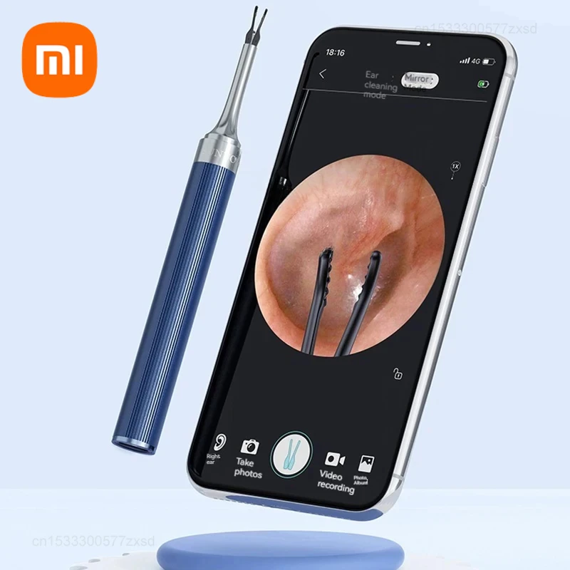 

Xiaomi New Sunuo Smart Visual Ear Sticks S9 1000W Pixels HD Endoscope Silicone Earpick Senseless Temperature Control Ear Forceps