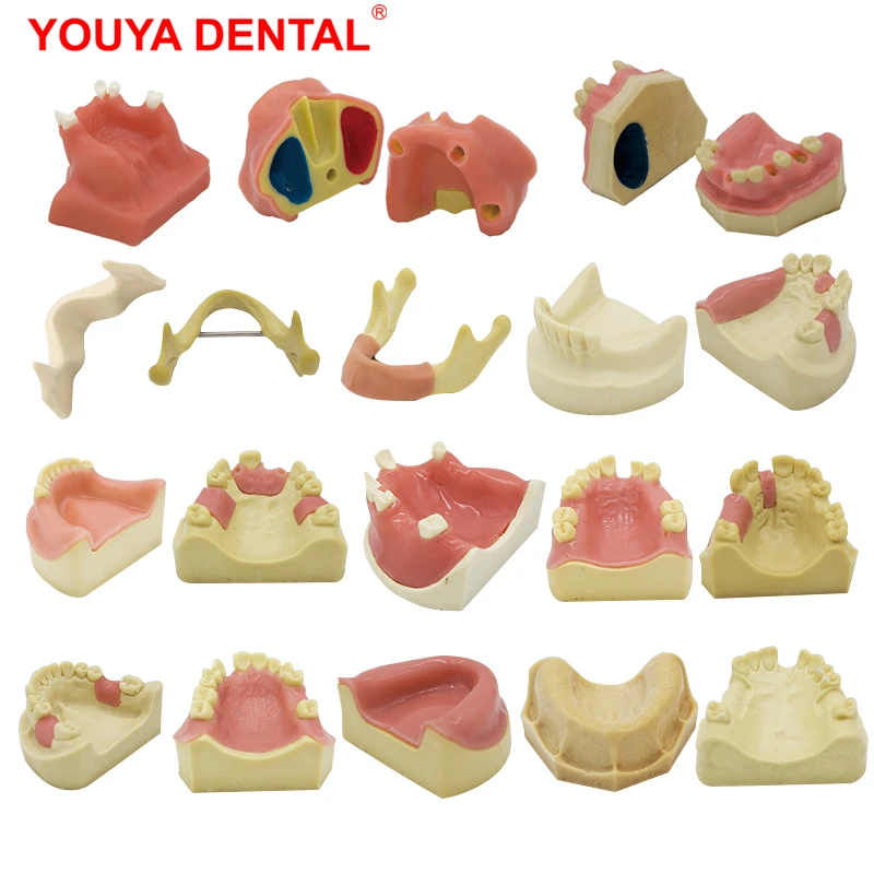 YOUYA 1 sztuk Model dentystyczny Implant zębów praktyka Model zębów Implant dentystyczny Model szkolenia wyświetlacz stomatologia ustne modele