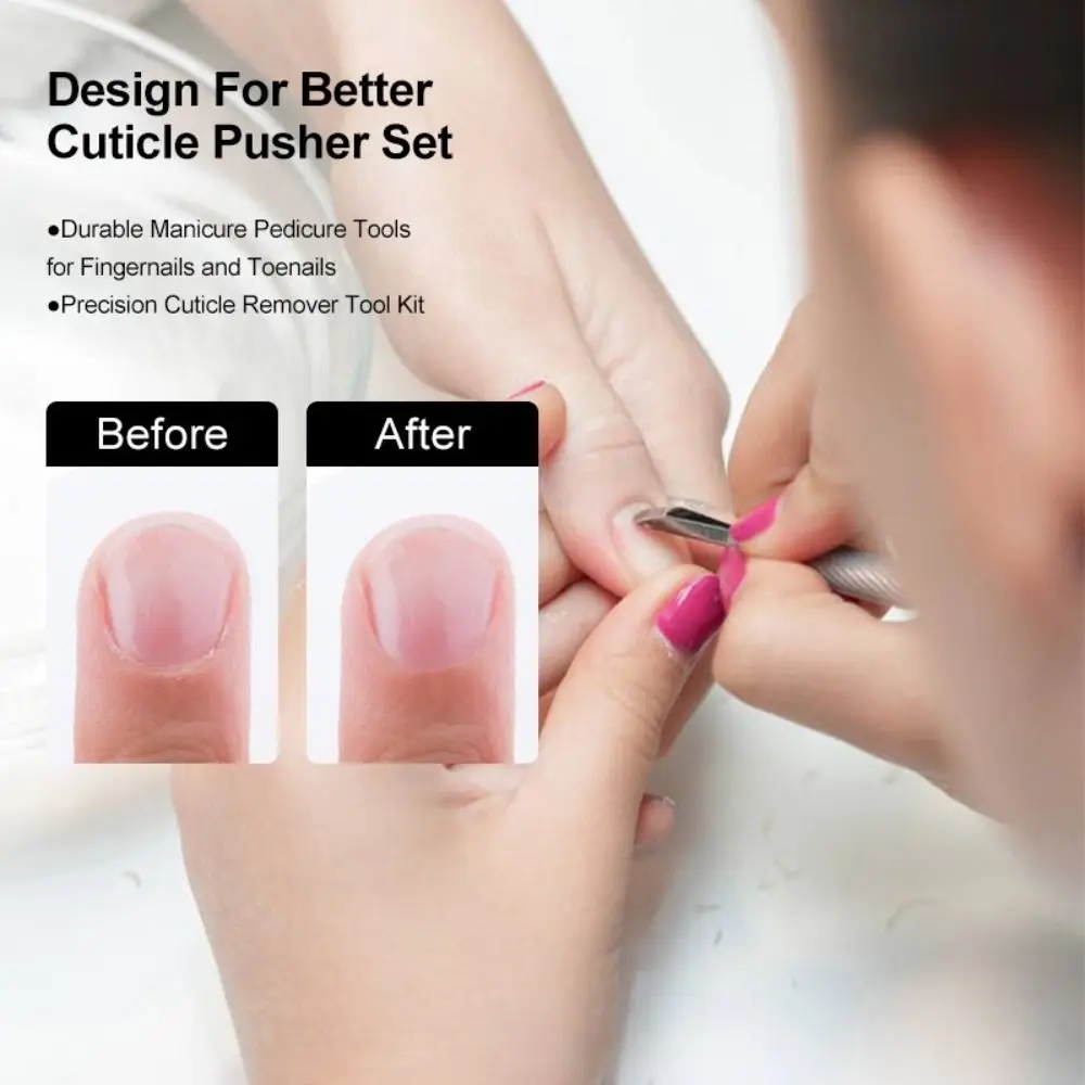 Stainless Steel Cuticle Pusher Double-Ended Double-Sided Dead Skin Remover Multicolor Beveled Steel Pedicure Tool Pedicure