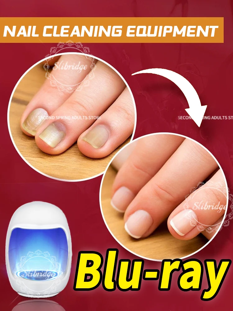 

Laser Product Solving Nail Problems,manicure,Effective treatment nail Fungus,remove onychomycosis,toenail,Fingernail,Blue light