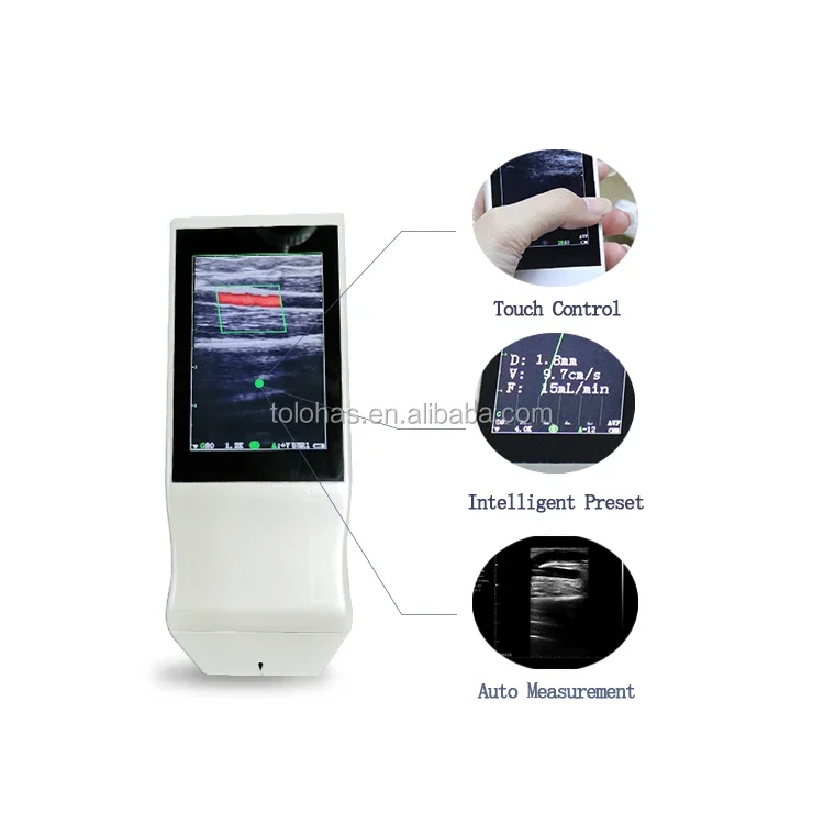 LHA5P Cheapest Portable Ultrasound machines For Sale / Wireless WiFi Handheld Color Doppler Ultrasound Machine