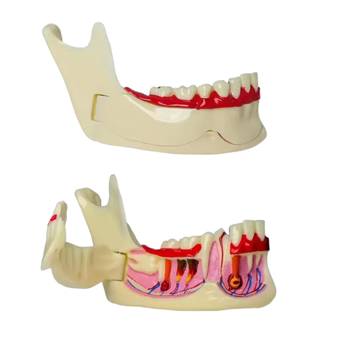 

Dental Low Jaw Endodontic Treatment Model Anatomy of Gums Right Mandible Tissue Anatomical Model Dentist Teaching Teeth Model