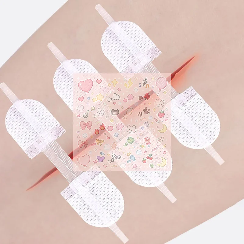 Strap Zipper Wound Closure Patches Breathable Seamless Elastic Zip Sutures Bandages For Wound Care Braces Supports