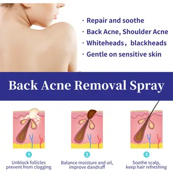 10 best sales Sırt sivilce spreyi - №4