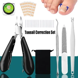 Ingrown Toenail Correction Tools Nail Treatment Toe Nail Sticker Foot Care Pedicure Foot Orthodontic Toe Thumb Nail Patches