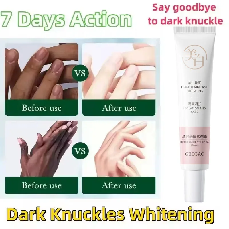 

Dark Knuckles Fast Brighten Cream Elbows Hands Knee Armpits Brightening Serum Clarify Black Skin Lighten Stains Remover Essence