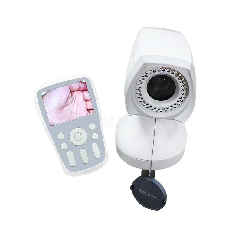 SY-F005 Effective Hospital Digital Video Electronic Colposcopy for Gynecology Examination