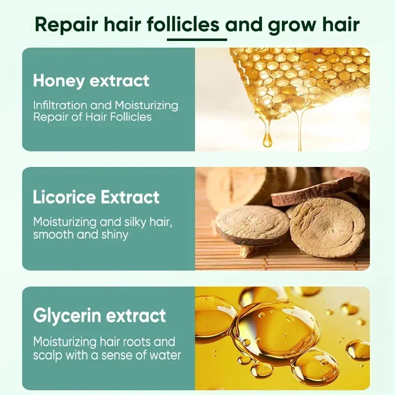 Hair Fast Growth Product Essential Oil for Men Women Natural Hair Loss Treatment Fast Grow Prevent Baldness Regrowth Thicken Oil