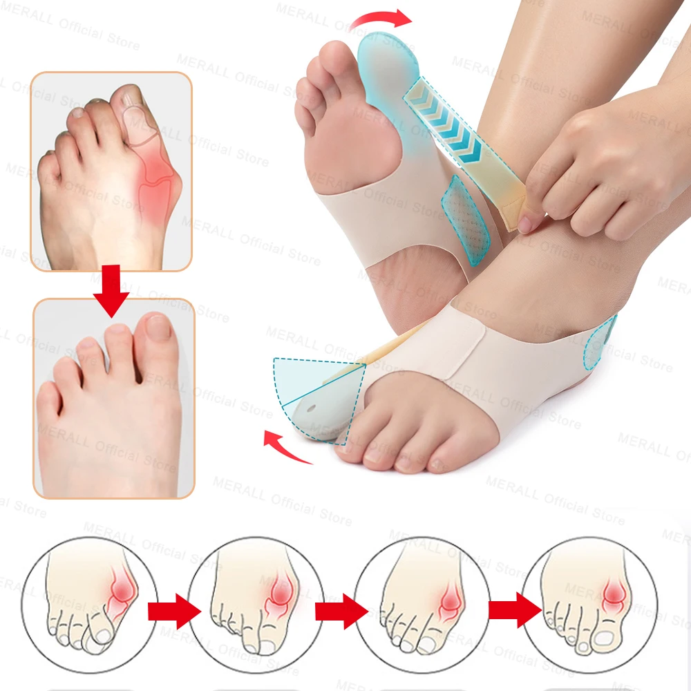 Big Toe Bunion Corrector Adjustable Orthopedic Socks Toes Separator Pain Relief Hallux Valgus Feet Protector Foot Care Tools