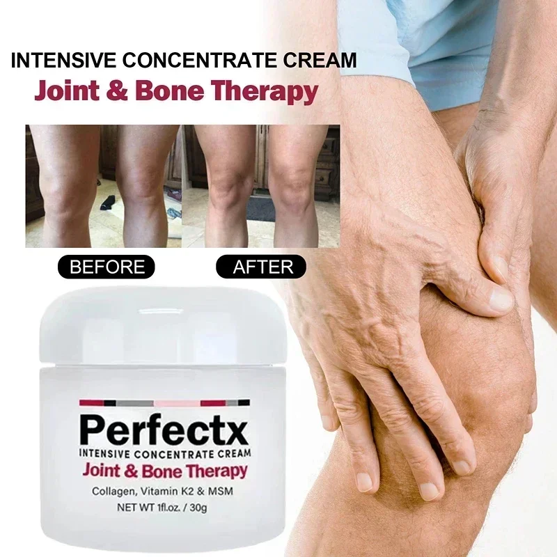 Perfectx crema reparadora de articulaciones, crema para aliviar el dolor de rodilla, columna Lumbar, pierna, cuello, salud corporal, cuidado activo de las articulaciones, 30G