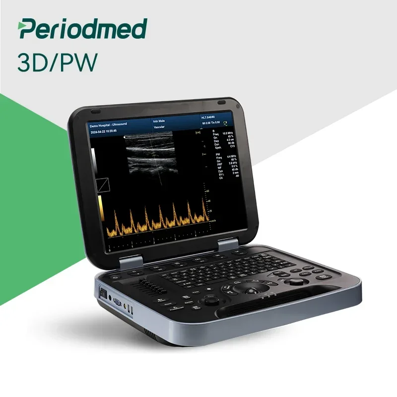 Periodmed 3D Double Probe Portable Ultrasound Black And White Ultrasound Machine China Portable Ultrasound Machine