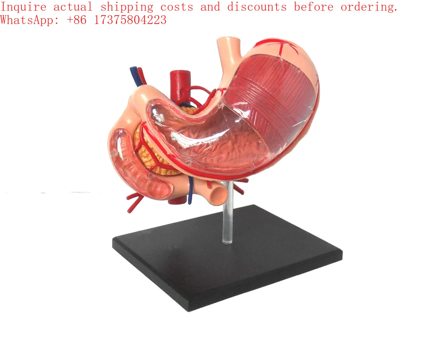 2026 Stomach 9 parts Anatomical Model