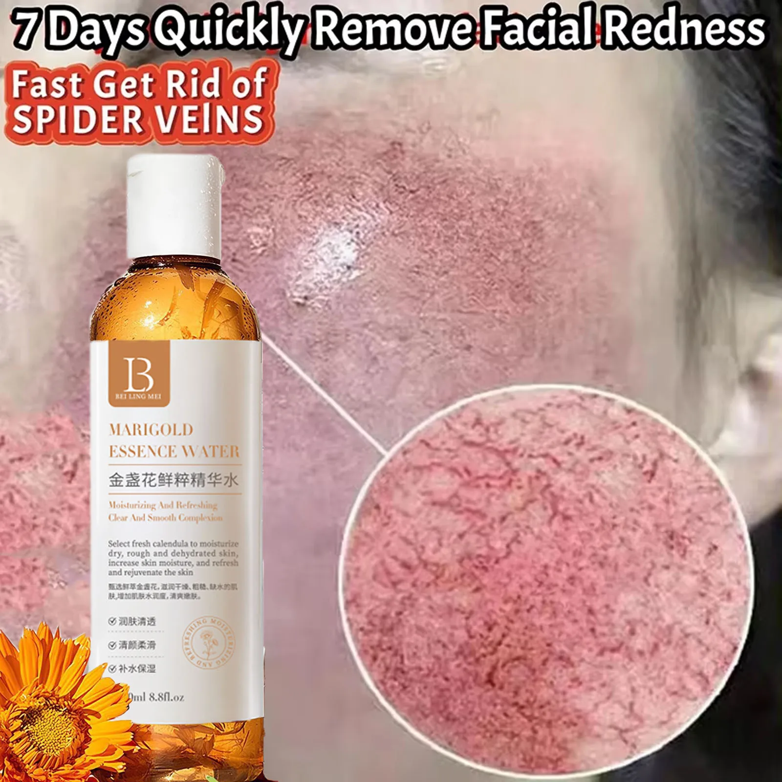 Calendula Toner Moisturizing Repair Oil Control Soothing Serum Acne Remover Lifting Firming Wrinkles Glowing Facial Care 250ml