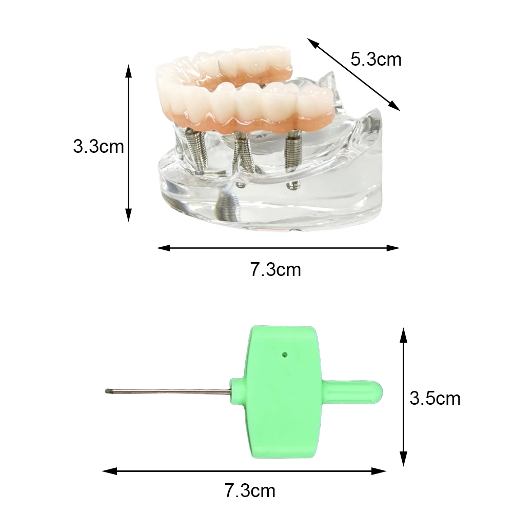 Upper Jaw Dental Implant Model 6 Implants Maxillary Overdenture Teeth Model For Training Practice Education Studying Teaching