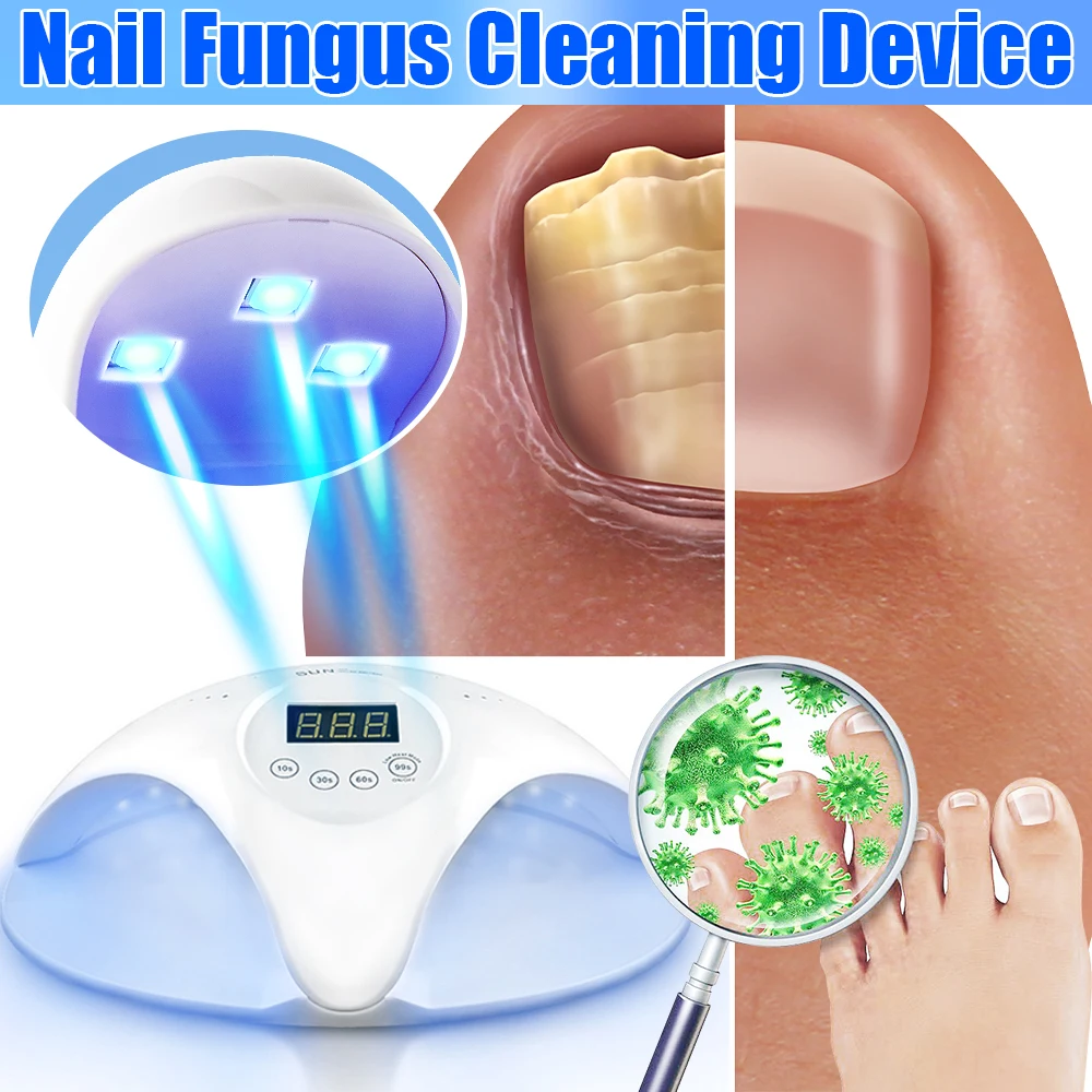 Anti-Fungal Skin Laser Device Hand Foot Skin Repair Herbal Ointment Nail Fungus Removal Anti-Infection Paronychia Skin Care Tool