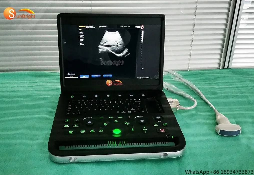 New arrival Medical equipment Professional color diagnostic ultrasound system