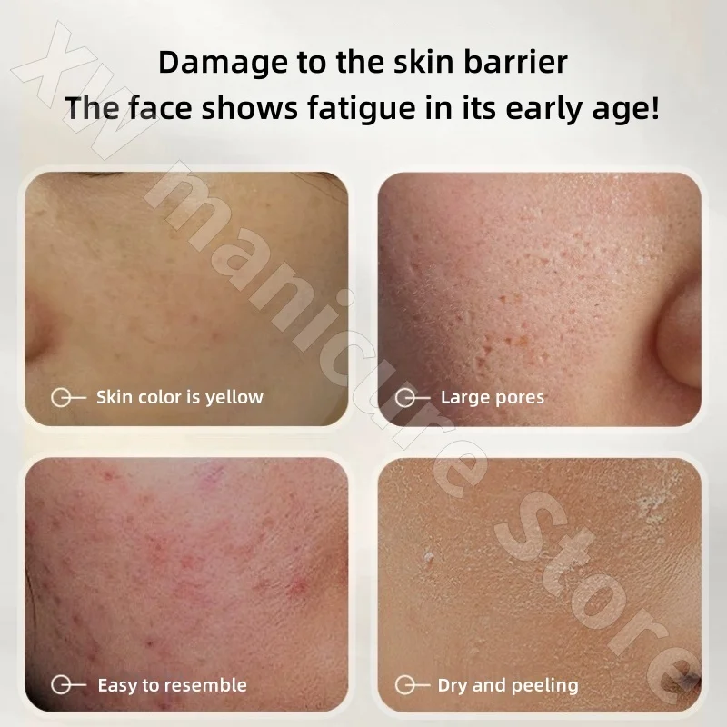Anua Moisturizing, Soothing, Moisturizing and Brightening Skin Tone 80+ Houttuynia Cordata Essence Delicate Skin
