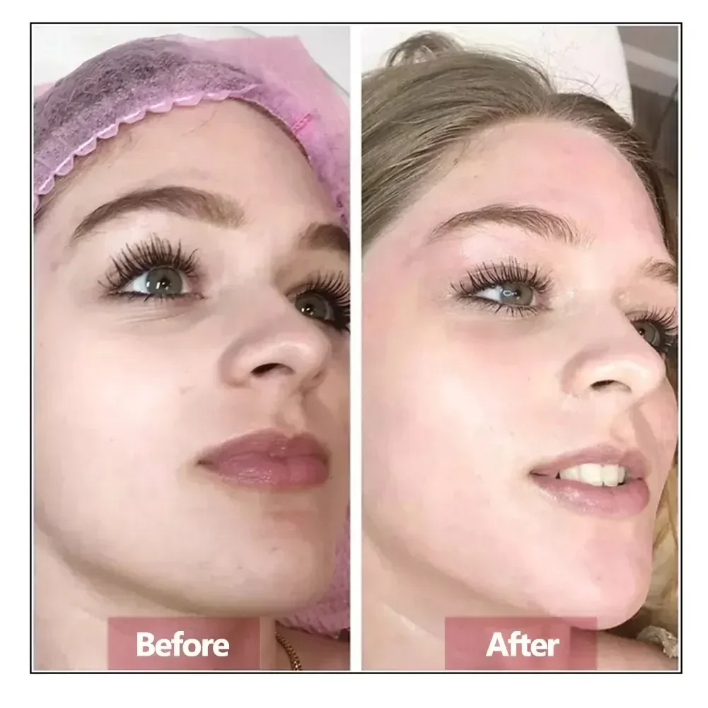 L'essenza viso all'acido ialuronico idrata la pelle