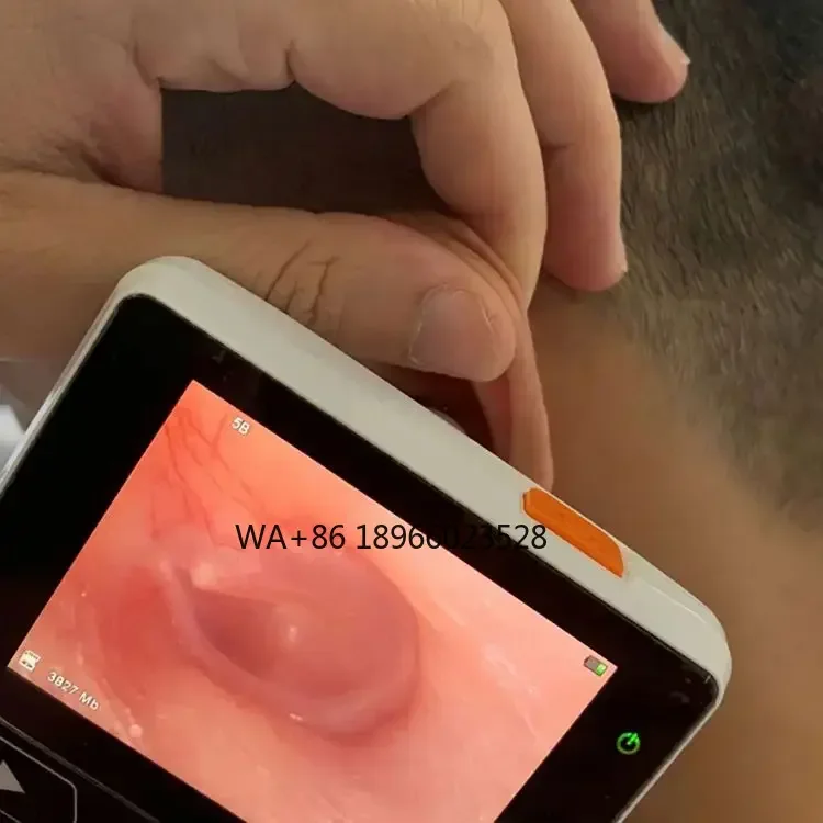 

Ear Otoscope Digital Video Otoscope video Otoscope Set Ear Endoscope