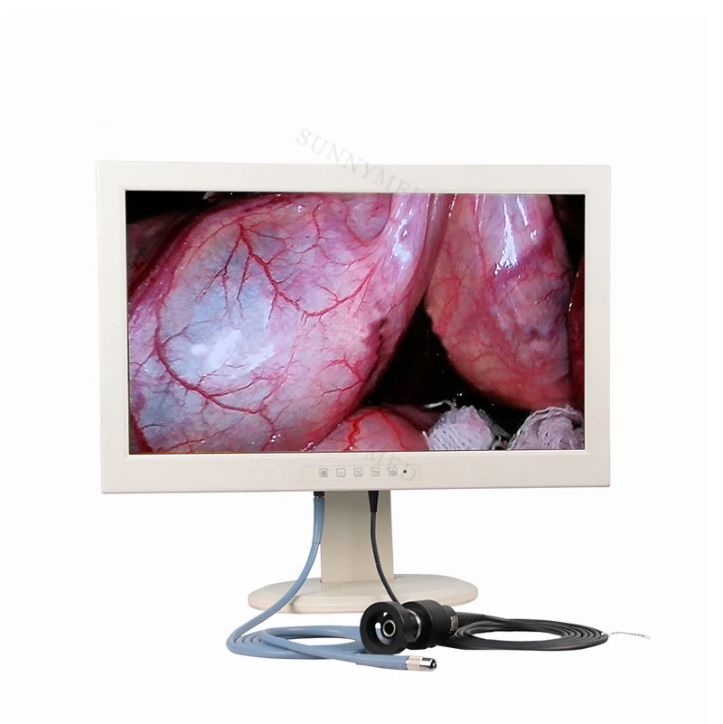 SY-PS047 21Inch Rigid Endoscope with LED Light Source All in One Integrated Endoscopy medical endoscopy  with