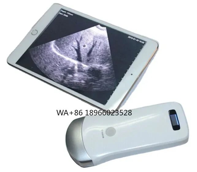 

Handheld Wifi Black And White Ultrasound Machine Android MSLPU40 Wireless Convex Array Ultrasound Scanner Portable Abdomen Probe