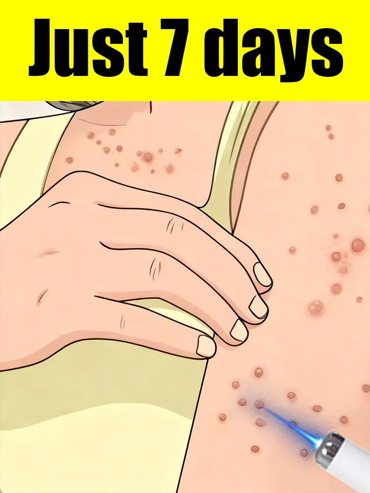 

Laser treatment smooths out warts and improves the skin's surface environment.