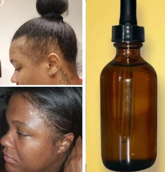 

Potent 100 Ayurvedic Mega Growth Hair Beard Oil Thickens Strengthens Fast Absorbing Lightweight Non Greasy All Hair Types