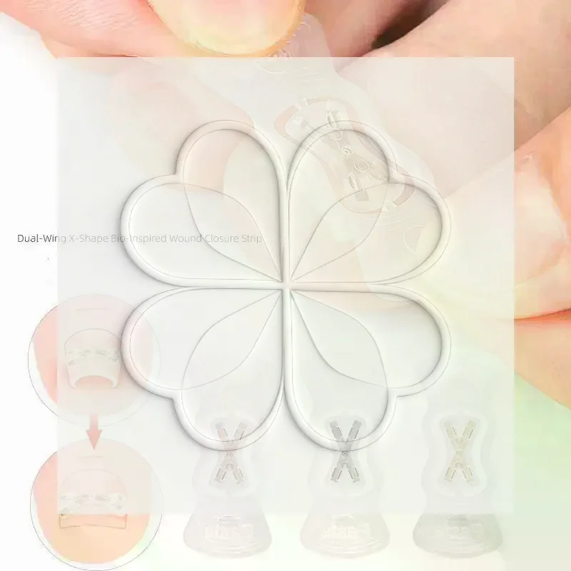 Ingrown Toenail Corrector Stickers 13-17mm High Elasticity Paronychia Treatment Foot Care Tool for Toe Nail Recovery