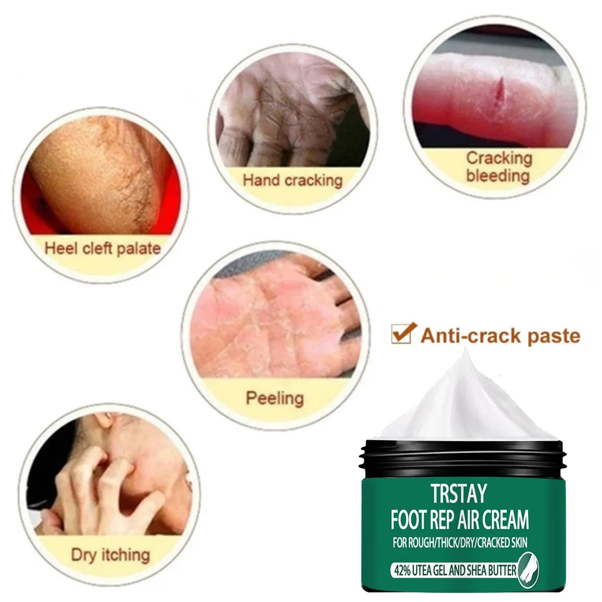 Foot urea repair cream moisturizing anti-freeze skin whitening cream  crema para blanquear la cara