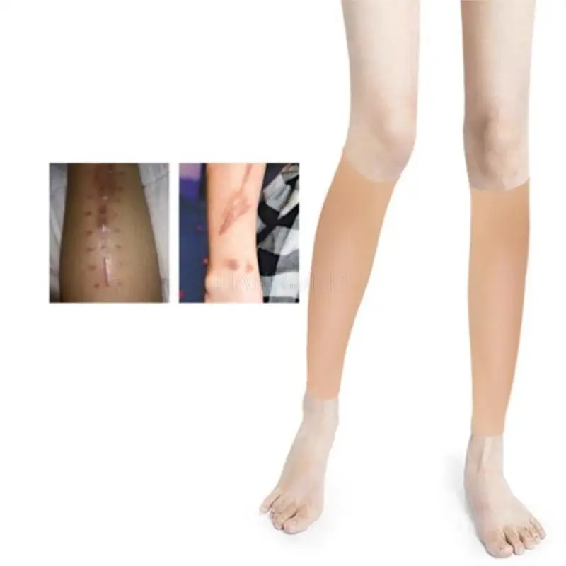 Highly elastic silicone gel simulates skin to cover scars, birthmarks, and burns invisibly