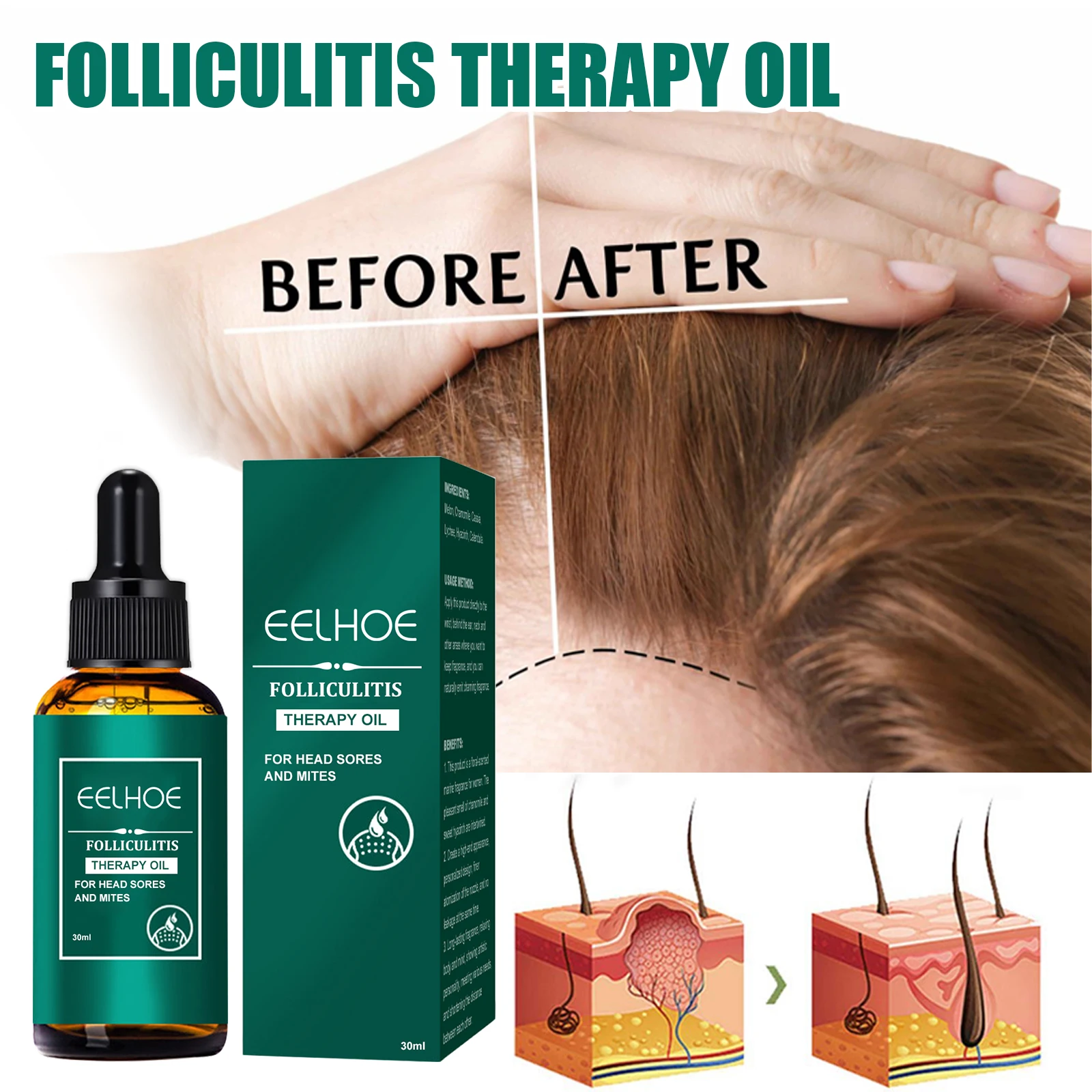 Scalp Treatment Serum Follicle - Roots Nutrition & Fitness Inglewood Photos 评论和价格