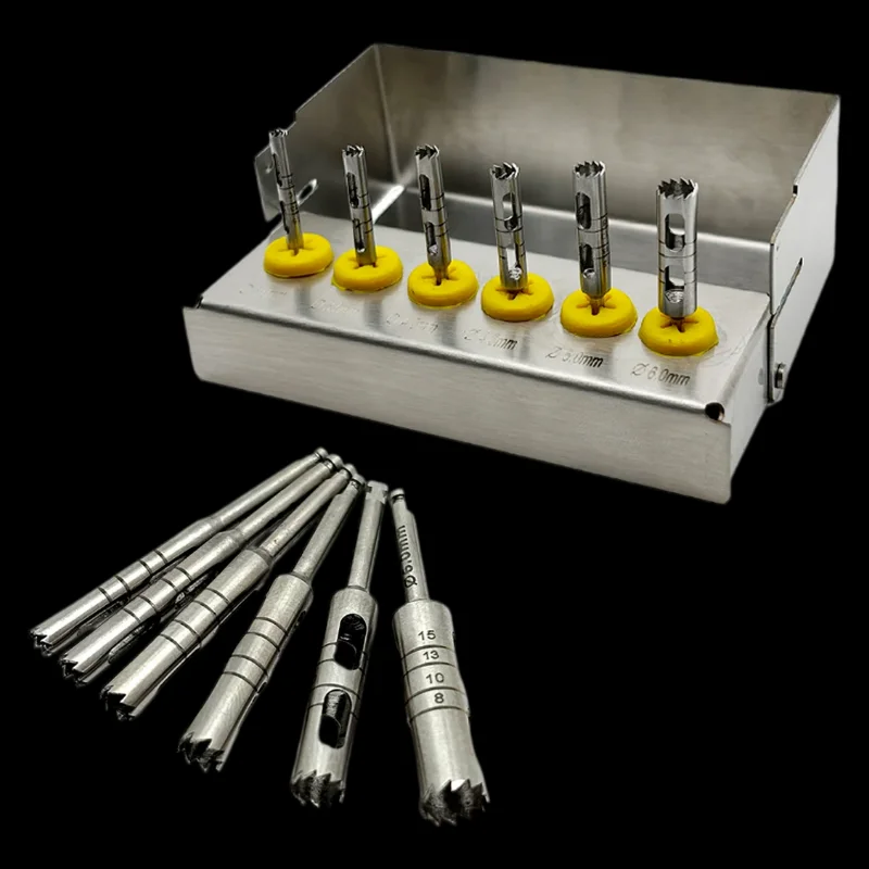 

Стоматологический трепан-пунш для имплантатов, хирургический инструмент из нержавеющей стали для перфорации тканей при имплантации