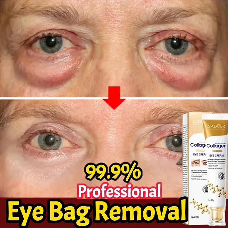 

Instant Eye Bag Removal Cream Collagen Tightening Firming Anti-Wrinkle Fade Fine Lines Anti-Puffiness Brighten Eye Care Product